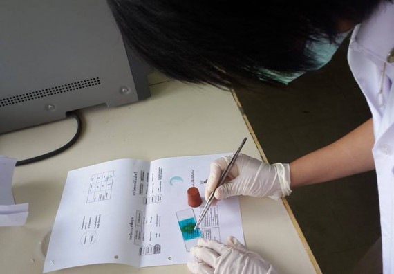 ภาพกิจกรรม โปรแกรมวิชาชีววิทยา จัดการอบรมเชิงปฏิบัติการตรวจหาไข่พยาธิ