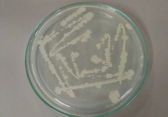 ภาพกิจกรรม โปรแกรมวิชาชีววิทยา จัดการอบรมเชิงปฏิบัติการ เรื่องการเพาะเลี้ยงเนื้อกล้วยไข่