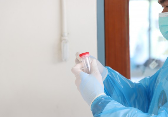 ภาพกิจกรรม  ศูนย์วิทยาศาสตร์และวิทยาศาสตร์ประยุกต์ จัดอบรมเชิงปฏิบัติการสกัด DNA จากตัวอย่างข้าว โดยใช้ชุด DNA extraction kit และการศึกษาวิธีการตรวจโควิด 19 ด้วยวิธี RT-PCR