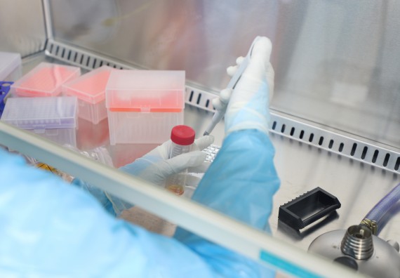 ภาพกิจกรรม  ศูนย์วิทยาศาสตร์และวิทยาศาสตร์ประยุกต์ จัดอบรมเชิงปฏิบัติการสกัด DNA จากตัวอย่างข้าว โดยใช้ชุด DNA extraction kit และการศึกษาวิธีการตรวจโควิด 19 ด้วยวิธี RT-PCR