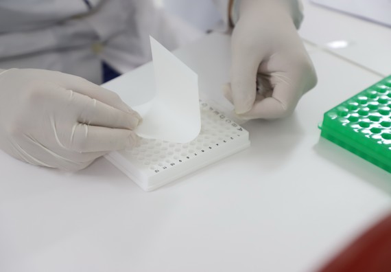 ภาพกิจกรรม  ศูนย์วิทยาศาสตร์และวิทยาศาสตร์ประยุกต์ จัดอบรมเชิงปฏิบัติการสกัด DNA จากตัวอย่างข้าว โดยใช้ชุด DNA extraction kit และการศึกษาวิธีการตรวจโควิด 19 ด้วยวิธี RT-PCR