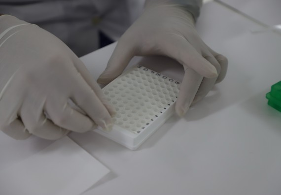 ภาพกิจกรรม  ศูนย์วิทยาศาสตร์และวิทยาศาสตร์ประยุกต์ จัดอบรมเชิงปฏิบัติการสกัด DNA จากตัวอย่างข้าว โดยใช้ชุด DNA extraction kit และการศึกษาวิธีการตรวจโควิด 19 ด้วยวิธี RT-PCR